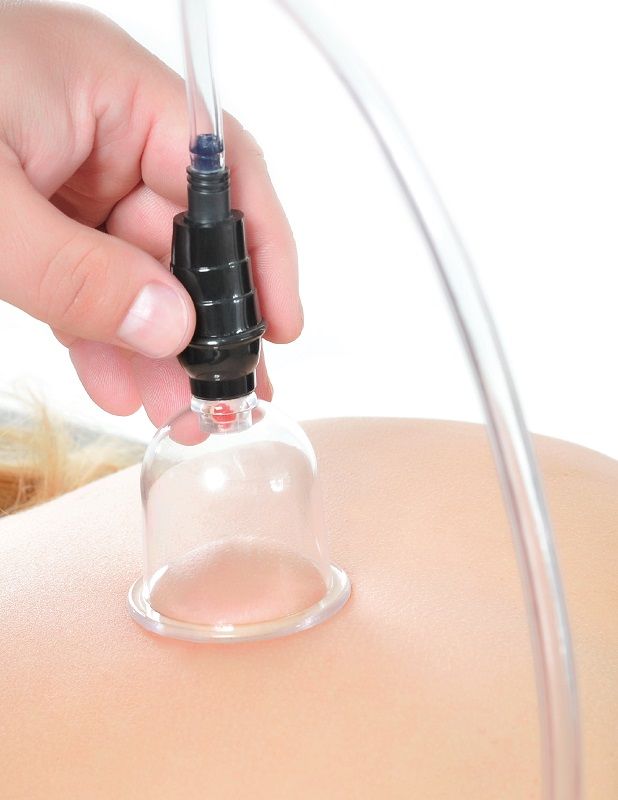 FETISH FANTASY SERIES - 6-PIECE SUCTION SET FETISH FANTASY SERIES NOCTURNA DESIRES